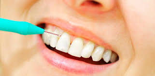 Dental Floss and Interdental Cleaners